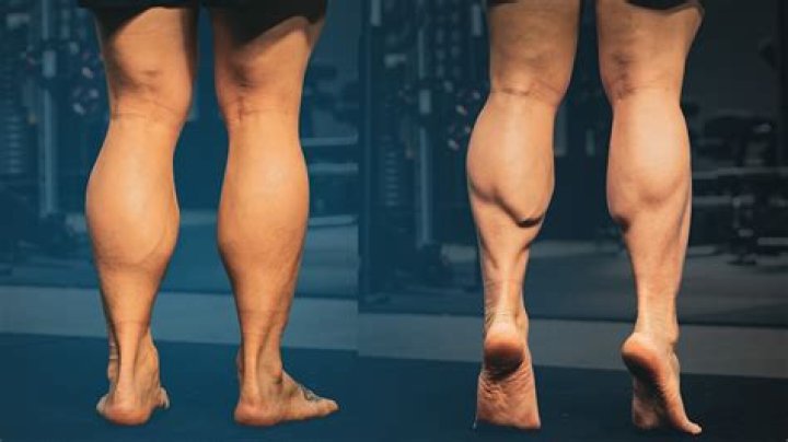 Are twin calves rare?