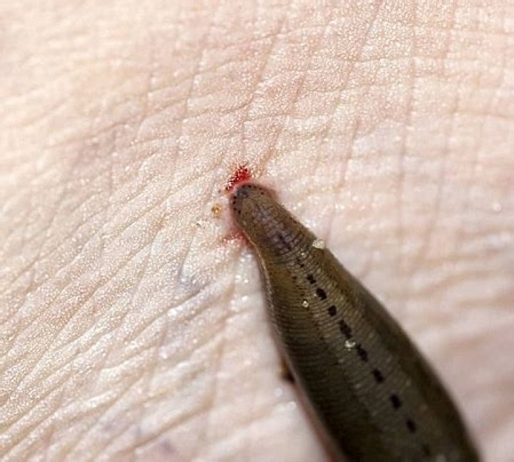Bloodsucking worm
