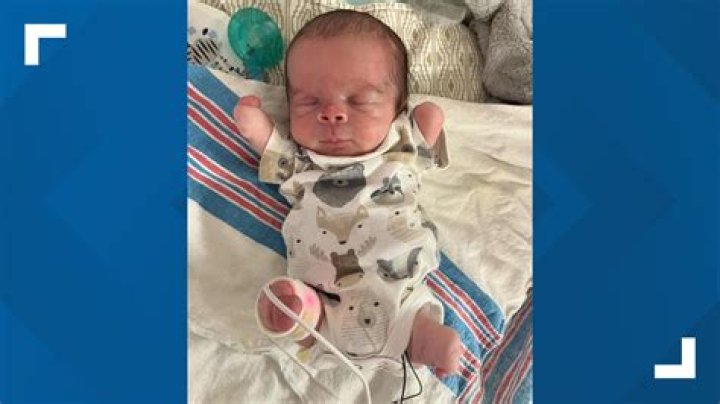 Can babies be born without skin?