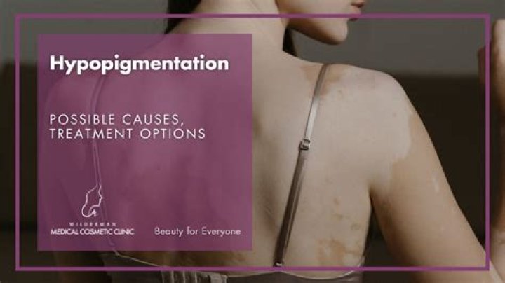 Can dermatologists treat hypopigmentation?