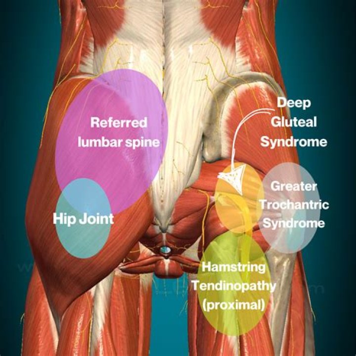 Can Sjogren's cause hip pain?