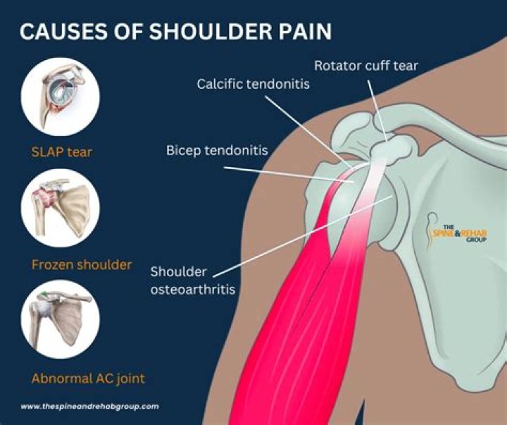 Can ulcers cause muscle pain?