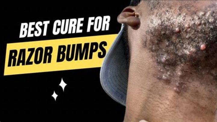 Can you ever get rid of a mum tum?