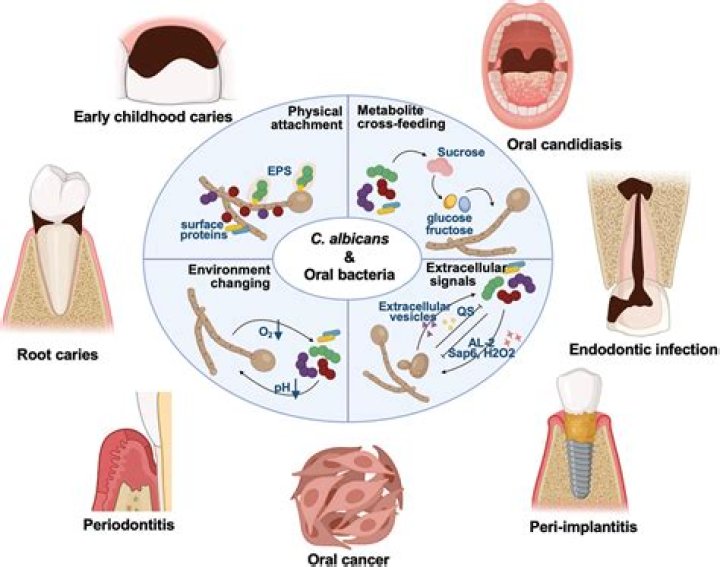 Candies such as After Eights