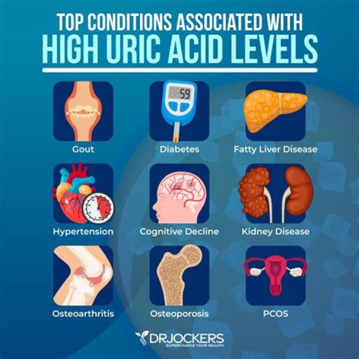Does onion increase uric acid?
