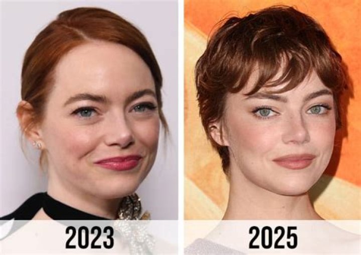 Emma Stone Face Lift: Unveiling the Truth Behind Her Stunning Transformation