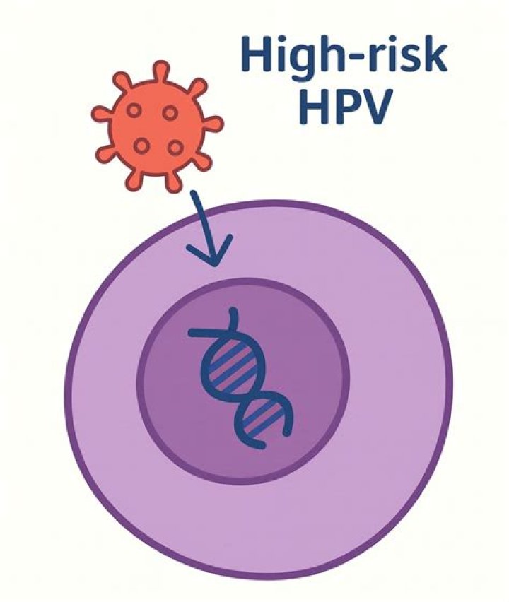How do I know if I have high risk HPV?