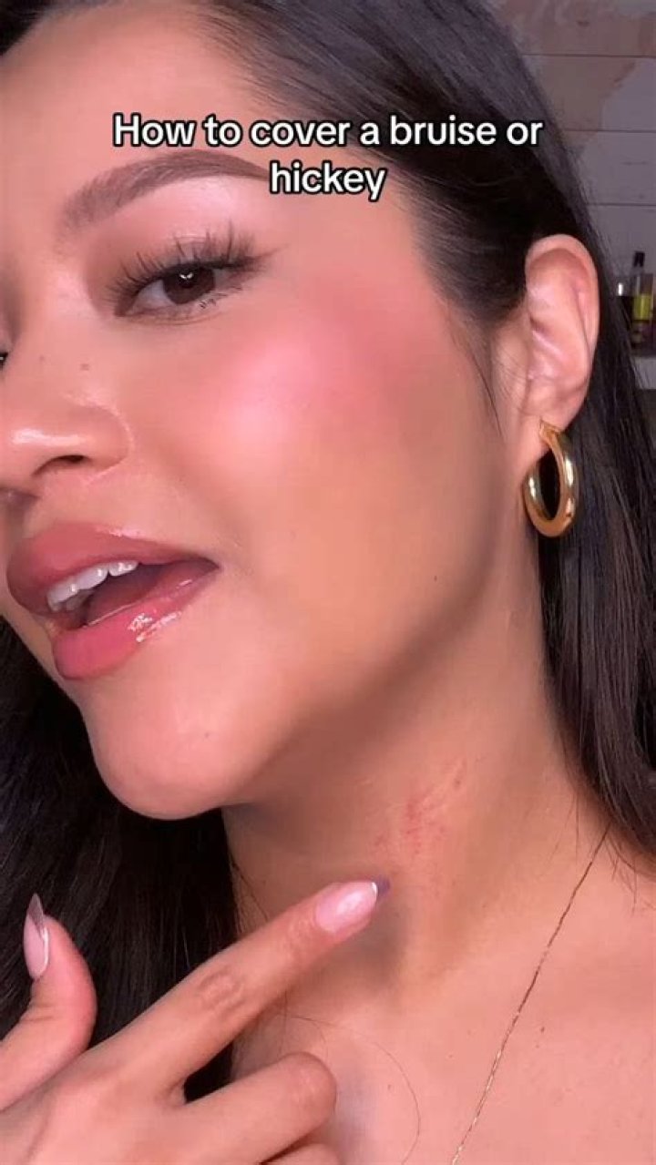 How do you cover hickeys with toothpaste?