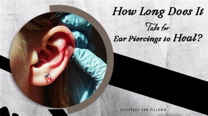 How long does a stitched gum take to heal?