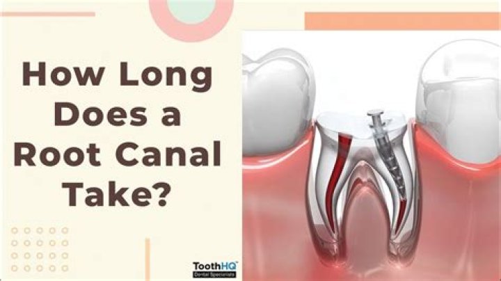 How long should a root canal last?