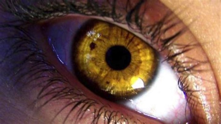 Is it possible to have gold eyes?