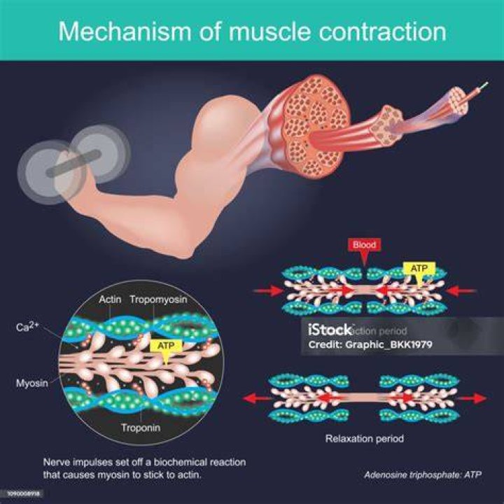Painful muscle contraction