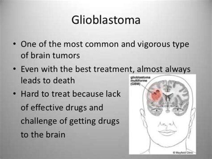 What are the warning signs of glioblastoma?