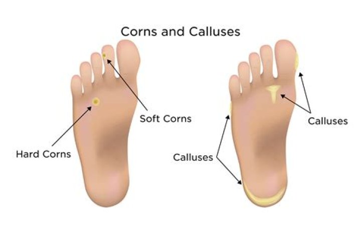 What causes numbness in ball of foot and toes?