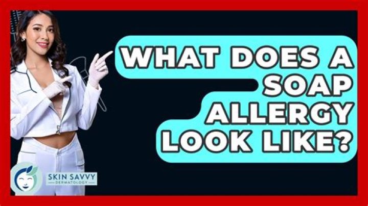 What does soap allergy look like?