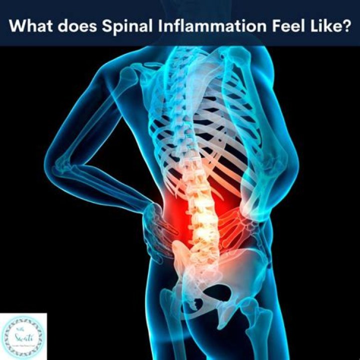 What does spine inflammation feel like?