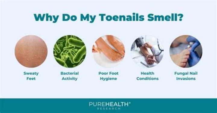 What does toe jam smell like?