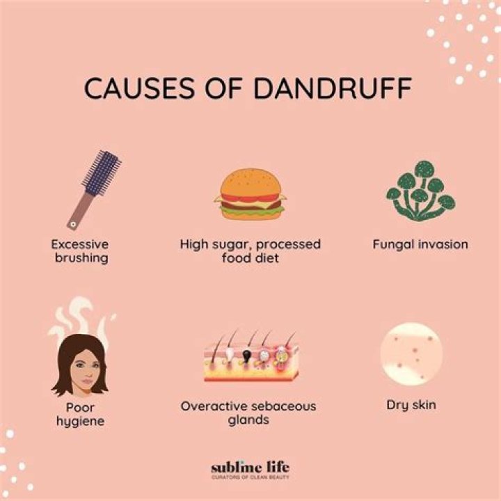 What foods cause dandruff?