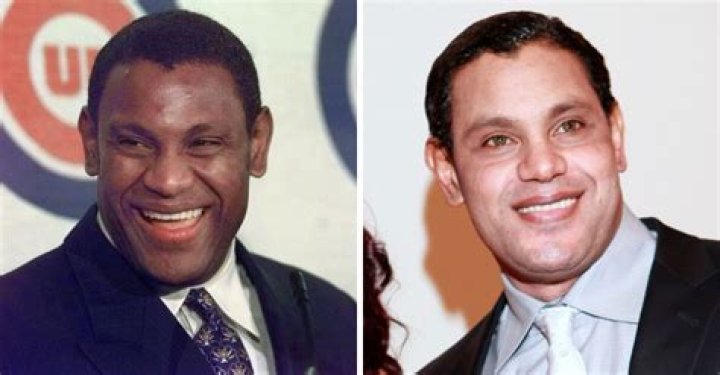 What happened to Sammy Sosa's skin?