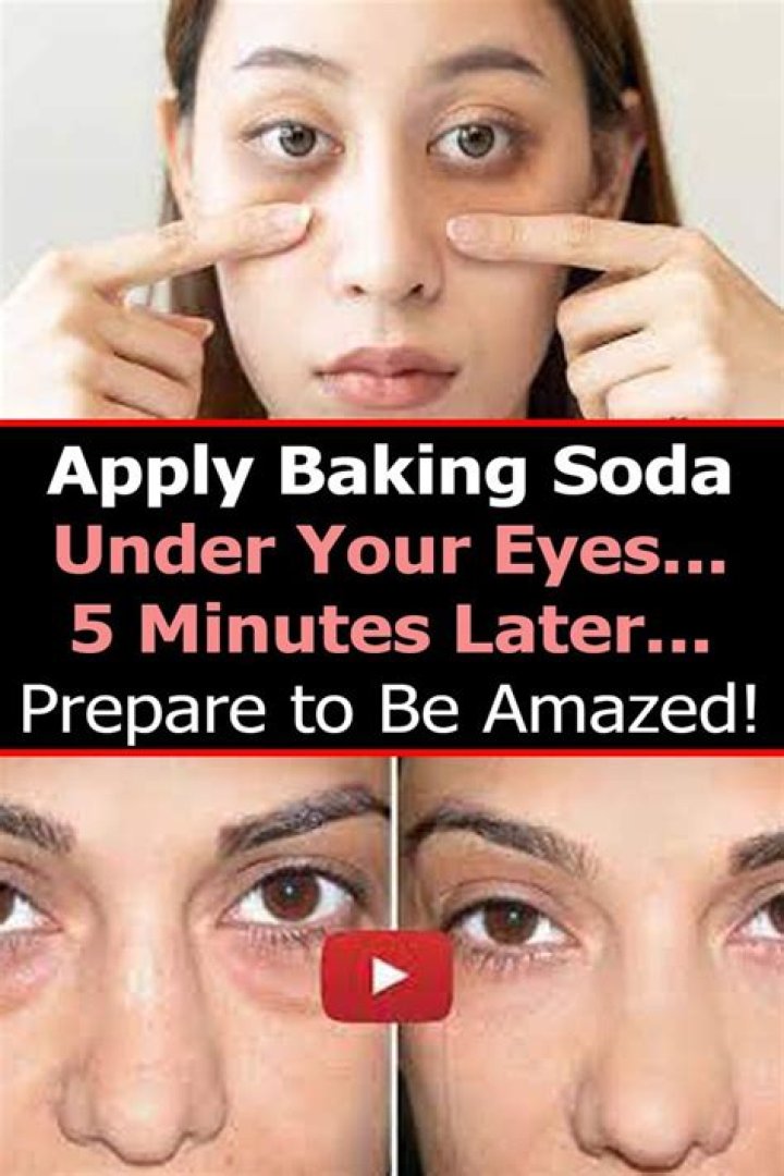 What happens if you put baking soda under your eyes?