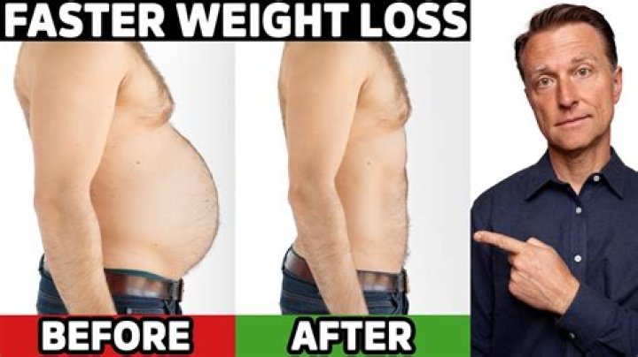 What is considered extreme weight loss?