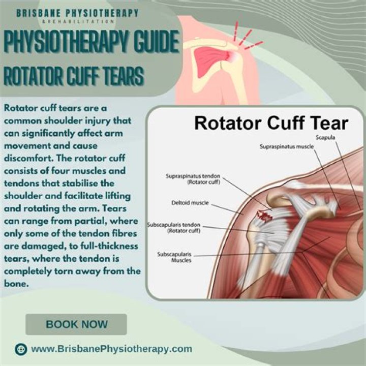 Where does rotator cuff pain hurt?