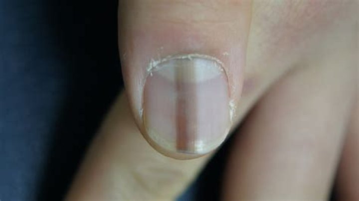 Why are my nails black?