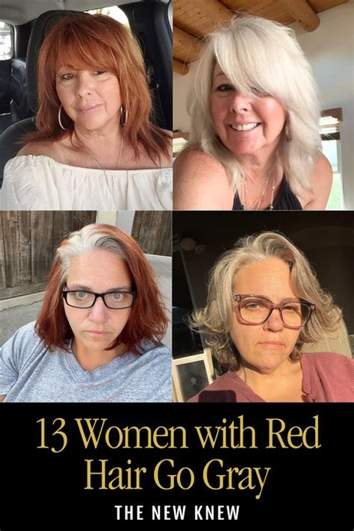 Why do redheads go bald?