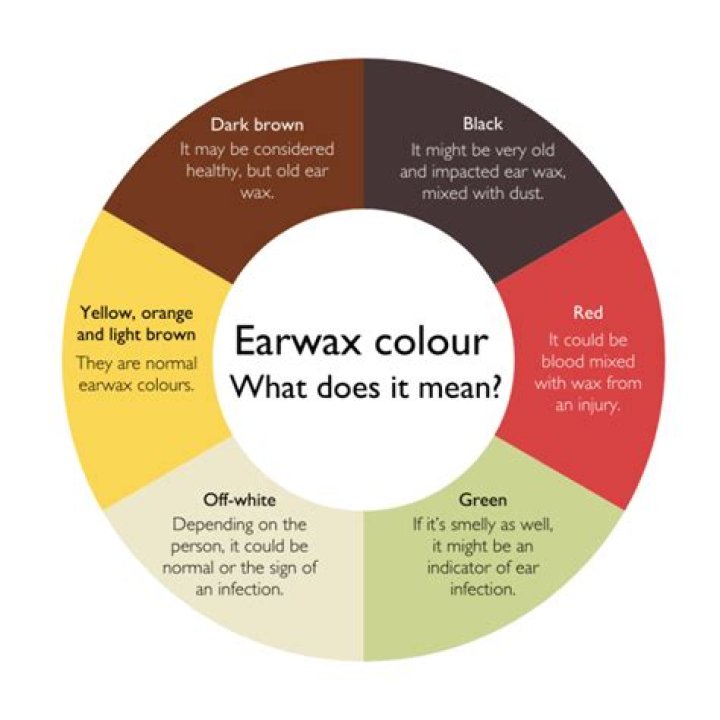 Why is my earwax yellow and wet?