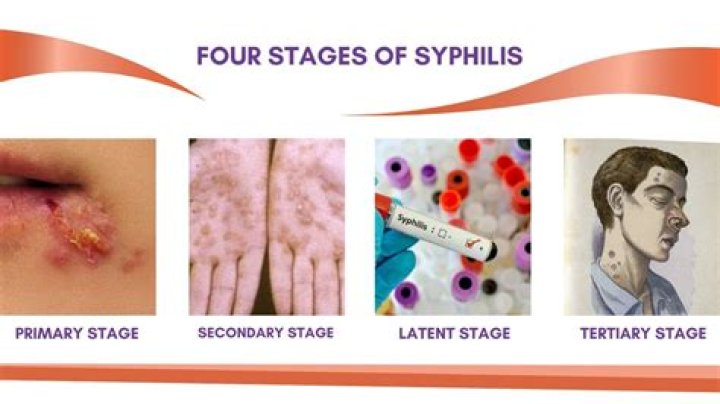 Why is syphilis more common in males?